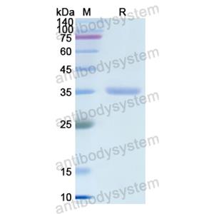 Recombinant Human CA8, N-His