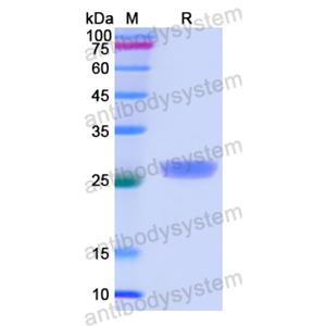 Recombinant Human CTNNA1, N-His