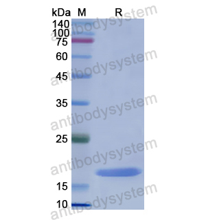 ADRA1A,Recombinant Human ADRA1A, N-His