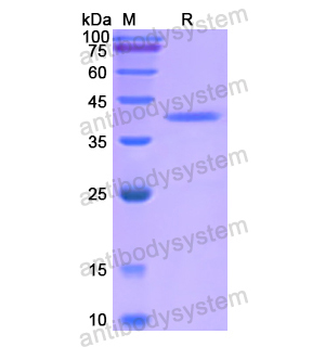 RORA,Recombinant Human RORA, N-SUMO