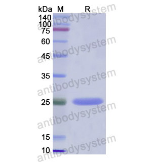 THBS2,Recombinant Human THBS2, N-His