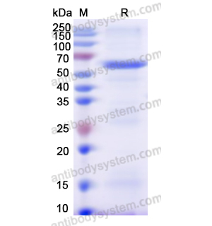 THBS4,Recombinant Human THBS4, N-GST