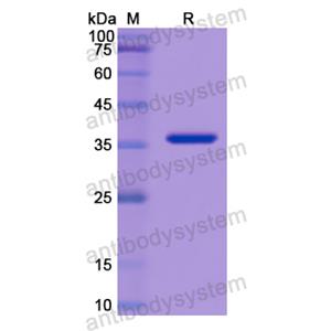 SFTPD,Recombinant Human SFTPD, N-His