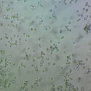 Karpas-299间变性大细胞淋巴瘤细胞,Karpas-299