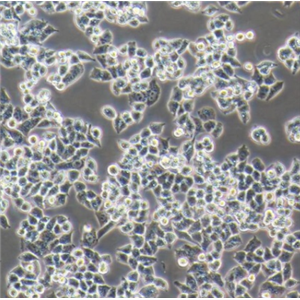 OVCA433 人卵巢癌细胞