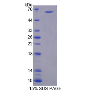 肽基精氨酸脱亚氨酶Ⅱ(PADI2)重组蛋白,Recombinant Peptidyl Arginine Deiminase Type II (PADI2)