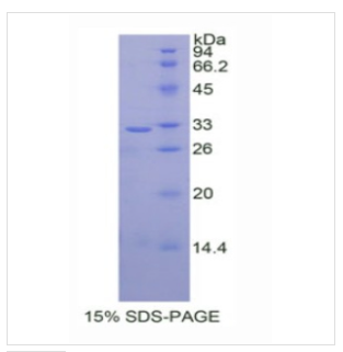 UDP葡糖醛酸基转移酶1家族多肽A1(UGT1A1)重组蛋白,Recombinant?UDP?Glucuronosyltransferase?1?Family, Polypeptide?A1?(UGT1A1)