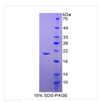 谷胱甘肽过氧化酶1(GPX1)重组蛋白,Recombinant Glutathione Peroxidase 1 (GPX1)