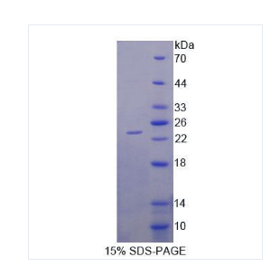 二肽酶2(DPEP2)重组蛋白,Recombinant Dipeptidase?2?(DPEP2)