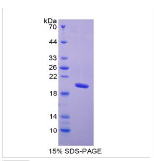 心钠肽(ANP)重组蛋白,Recombinant Atrial Natriuretic Peptide (ANP)