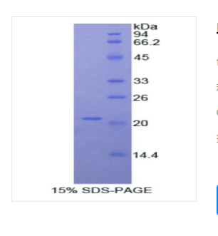 血小板反應(yīng)蛋白解整合素金禺肽酶12(ADAMTS12)重組蛋白,Recombinant A Disintegrin And Metalloproteinase With Thrombospondin?12?(ADAMTS12)