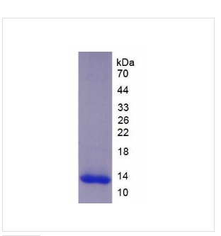 血小板反應蛋白解整合素金尾肽酶8(ADAMTS8)重組蛋白,Recombinant A Disintegrin And Metalloproteinase With Thrombospondin?8?(ADAMTS8)