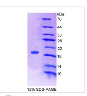 胃泌索抑制肽(GIP)重组蛋白,Recombinant Gastric Inhibitory Polypeptide (GIP)