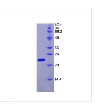 松弛肽2(RLN2)重组蛋白,Recombinant Relaxin?2?(RLN2)