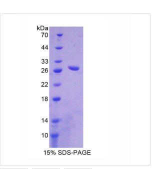 羧肽酶A1(CPA1)重组蛋白,Recombinant Carboxypeptidase?A1, Pancreatic (CPA1)