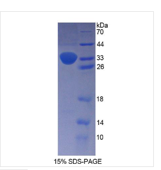 前腦啡肽(PENK)重組蛋白,Recombinant Proenkephalin (PENK)