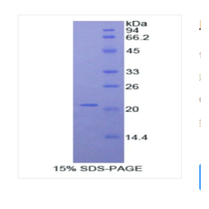 血小板反应蛋白解整合素金禺肽酶12(ADAMTS12)重组蛋白