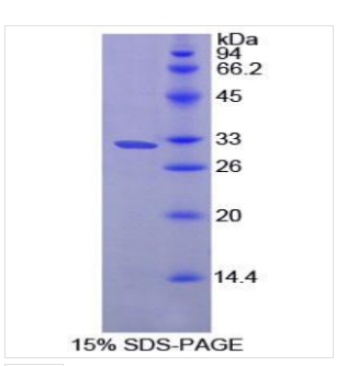 脯氨酰羧肽酶(PRCP)重组蛋白,Recombinant Prolylcarboxypeptidase (PRCP)