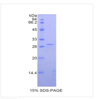 嘌呤霉素敏感性氨肽酶(PSA)重组蛋白,Recombinant Puromycin Sensitive Aminopeptidase (PSA)