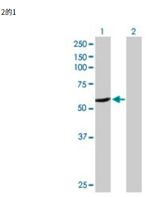 Anti-CYP2A6 antibody produced in rabbit,Anti-CYP2A