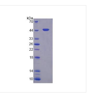 羧肽酶A4(CPA4)重组蛋白,Recombinant Carboxypeptidase?A4?(CPA4)