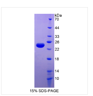 轻肽铁蛋白(FTL)重组蛋白,Recombinant Ferritin, Light Polypeptide (FTL)