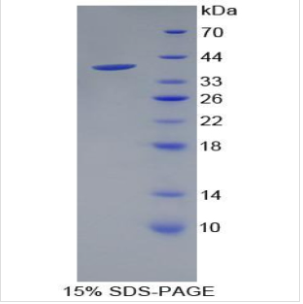 胰多肽(PP)重组蛋白,Recombinant Pancreatic Polypeptide (PP)