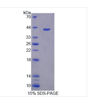 抗原肽转运蛋白1(TAP1)重组蛋白,Recombinant?Antigen?Peptide?Transporter?1?(TAP1)