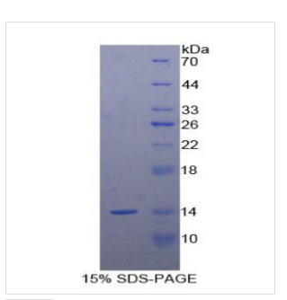 甘丙肽(GAL)重組蛋白,Recombinant Galanin (GAL)