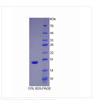 血小板反應(yīng)蛋白解整合素金屬肽酶4(ADAMTS4)重組蛋白,Recombinant A Disintegrin And Metalloproteinase With Thrombospondin?4?(ADAMTS4)