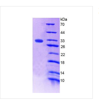 凝血因子XⅢA1肽(F13A1)重组蛋白,Recombinant Coagulation Factor XIII?A1?Polypeptide (F13A1)