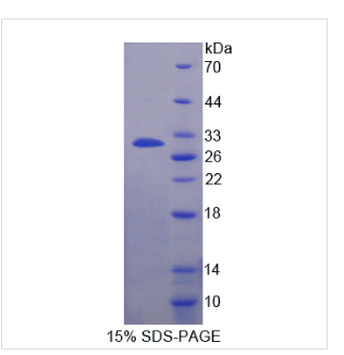 激肽释放酶10(KLK10)重组蛋白,Recombinant Kallikrein?10?(KLK10)