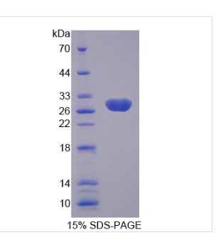 激肽释放酶4(KLK4)重组蛋白,Recombinant Kallikrein?4?(KLK4)