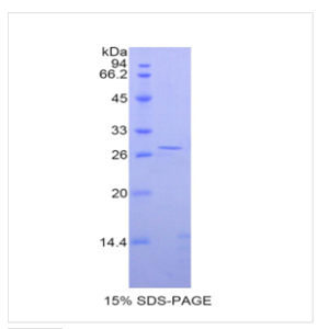 嘌呤霉素敏感性氨肽酶(PSA)重组蛋白,Recombinant Puromycin Sensitive Aminopeptidase (PSA)