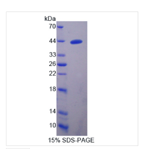 血小板反应蛋白解整台索金属肽酶16(ADAMTS16)重组蛋白