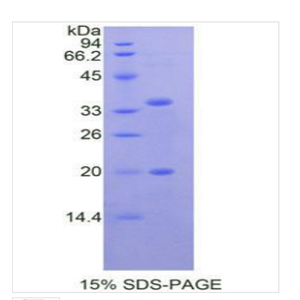 丝氨酸肽酶抑制因子KAZAL型5(SPINK5)重组蛋白