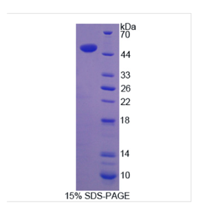 天冬酰胺内肽酶(LGMN)重组蛋白,Recombinant Legumain (LGMN)