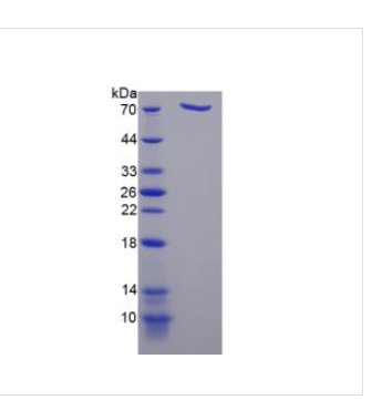 二肽基肽酶9(DPP9)重組蛋白,Recombinant Dipeptidyl Peptidase?9?(DPP9)