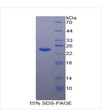 速激肽受体2(TACR2)重组蛋白,Recombinant Tachykinin Receptor?2?(TACR2)