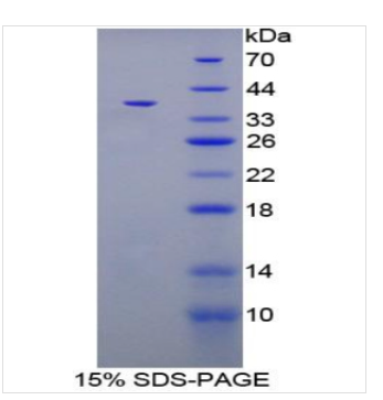 羧肽酶B1(CPB1)重组蛋白,Recombinant Carboxypeptidase?B1, Tissue (CPB1)