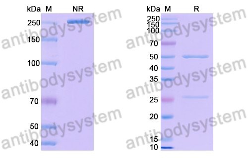 抗体：Human RAGE Antibody (XT-M4) RHH01901,RAGE/AGER