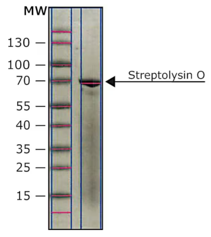 来自化脓性链球菌的链球菌溶血素O,Streptolysin O from Streptococcus pyogenes