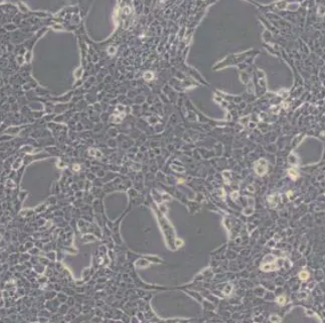 MKN-7细胞（人胃癌细胞）,MKN-7
