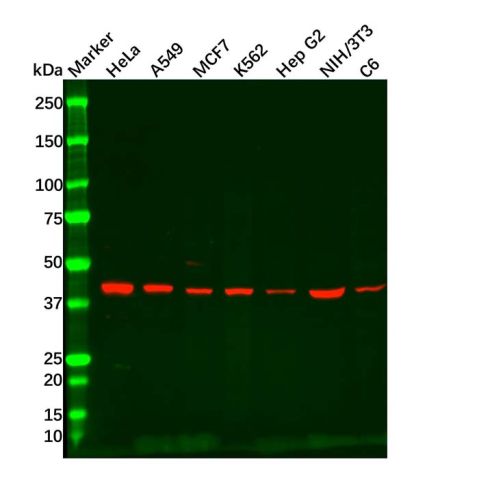 Recombinant ACADM/MCAD Antibody,Recombinant ACADM/MCAD Antibody