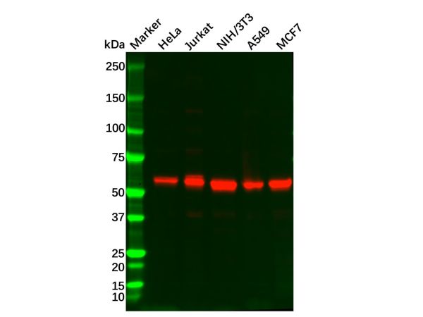 Recombinant AKT1/AKT2/AKT3 Antibody,Recombinant AKT1/AKT2/AKT3 Antibody