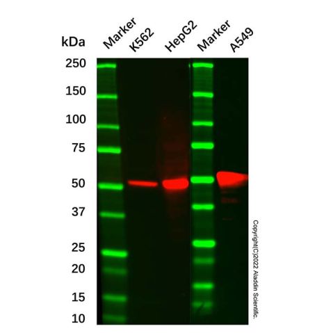 ALDH1A1 Mouse mAb,ALDH1A1 Mouse mAb