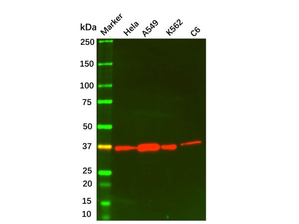 Annexin A1/ANXA1 Mouse mAb,Annexin A1/ANXA1 Mouse mAb