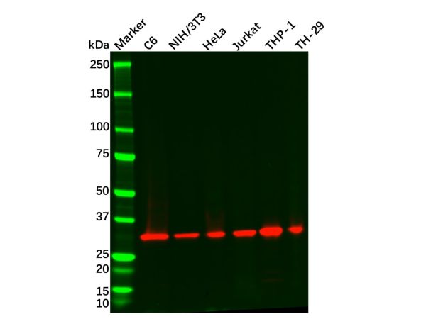 Recombinant ARPC2 Antibody,Recombinant ARPC2 Antibody