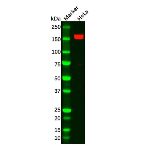 ASK1 Antibody,ASK1 Antibody