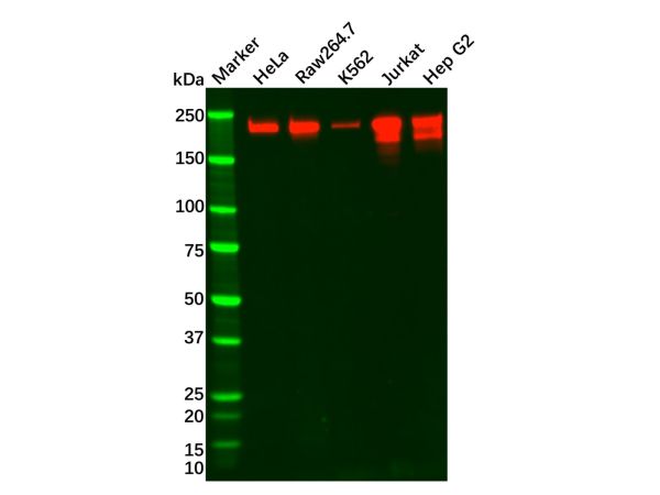 BRG1 Mouse mAb,BRG1 Mouse mAb